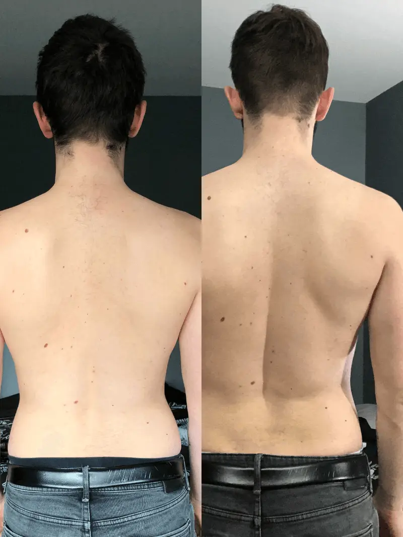 Pat - Back view