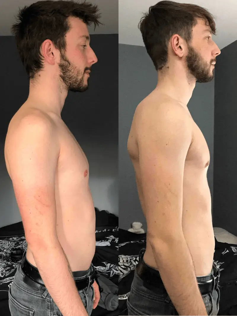 Pat - Side view
